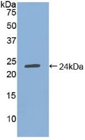 Figure . Western Blot