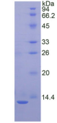 Figure . SDS-PAGE