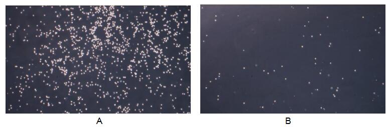 Figure .The chemotactic effect of IL8 on Jurkat cells.