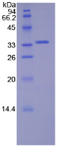 Figure . SDS-PAGE