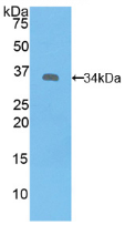 Figure . Western Blot