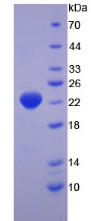 Figure . SDS-PAGE