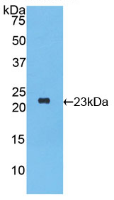 Figure . Western Blot