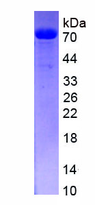 Figure . SDS-PAGE