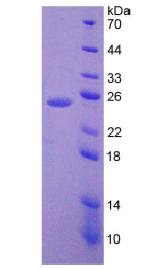 Figure . SDS-PAGE