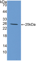 Figure . Western Blot