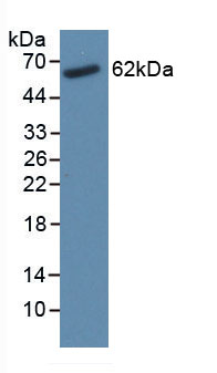 Figure . Western Blot
