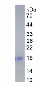 Figure . SDS-PAGE