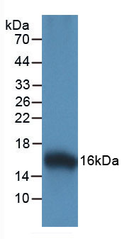 Figure. Western Blot