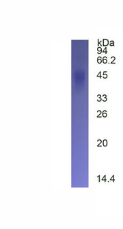 SDS-PAGE