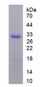 SDS-PAGE