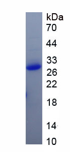 SDS-PAGE