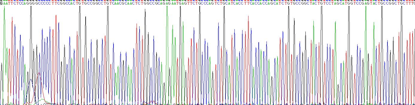 Gene Sequencing (extract)