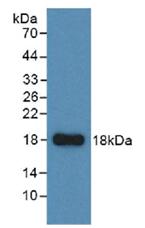 Western Blot