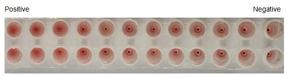 The hemagglutination assay of GAL2 in V- bottom shaped 96-well microtiter plate