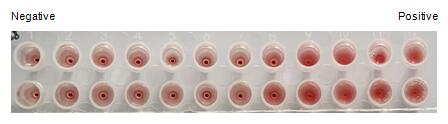 The hemagglutination assay of GAL7 in V- bottom shaped 96-well microtiter plate.