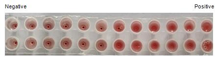 The hemagglutination assay of GAL7 in V- bottom shaped 96-well microtiter plate.