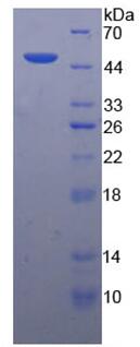 SDS-PAGE