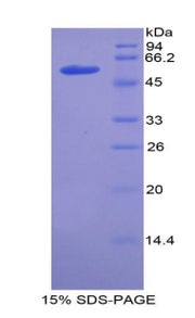 SDS-PAGE