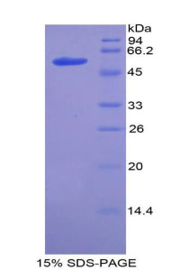 SDS-PAGE