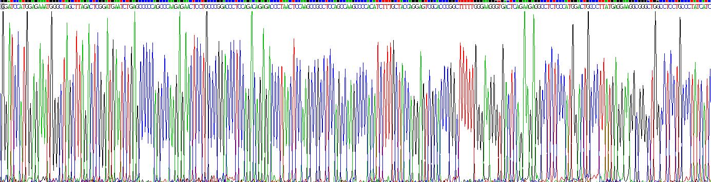 Gene Sequencing (extract)