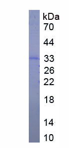 SDS-PAGE