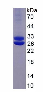 SDS-PAGE