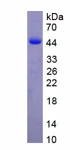 SDS-PAGE
