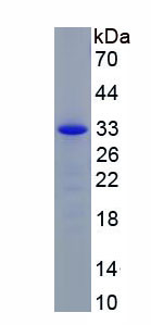 SDS-PAGE