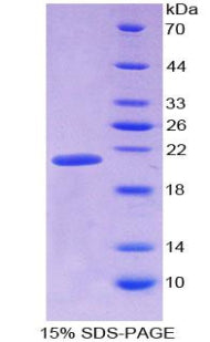SDS-PAGE