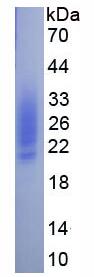 SDS-PAGE