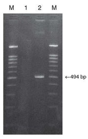 BcaBEST RNA PCR Kit - mRNA and cDNA synthesis - Takara Bio