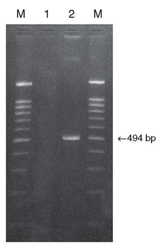 BcaBEST RNA PCR Kit - mRNA and cDNA synthesis - Takara Bio