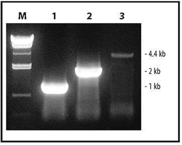 One-step RT-PCR - mRNA and cDNA synthesis - Takara Bio