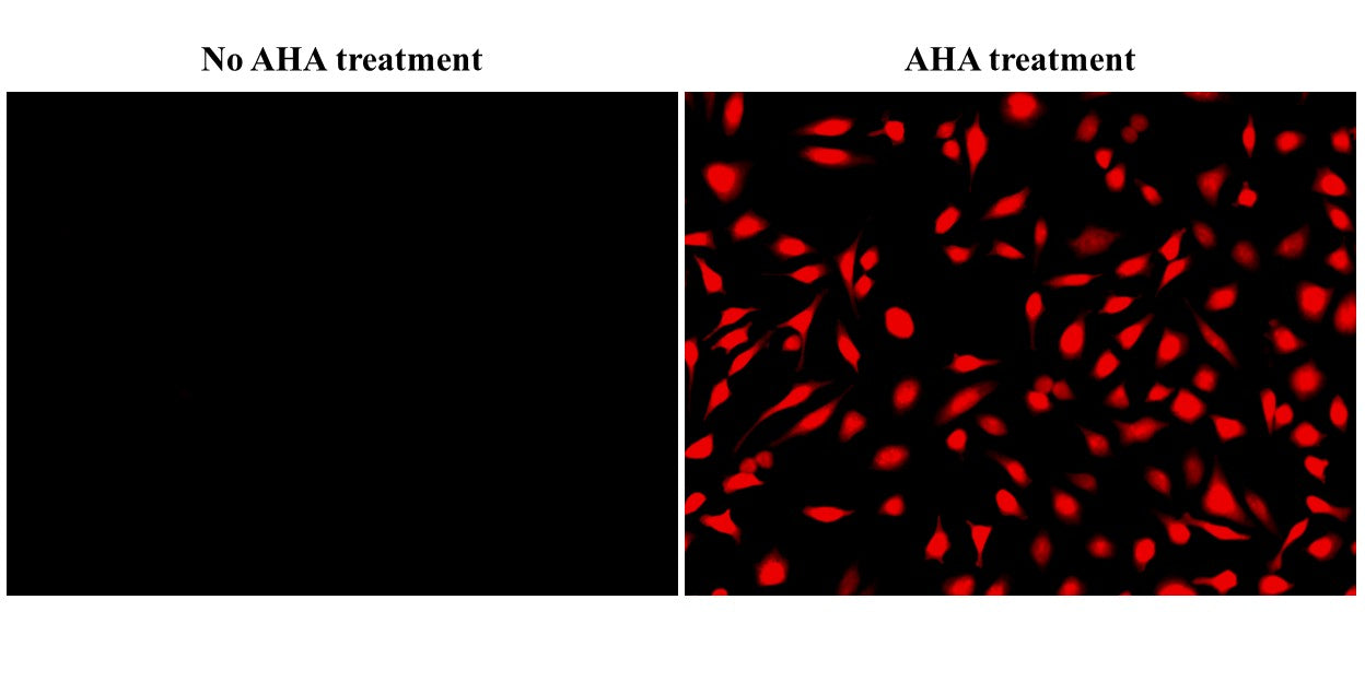 Bucculite™ iFluor® 555 Protein Synthesis Assay Kit *Red Fluorescence* - AAT Bioquest