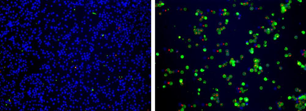 Cell Meter™ Apoptotic and Necrotic Multiplexing Detection Kit I *Triple Fluorescence Colors* - AAT Bioquest