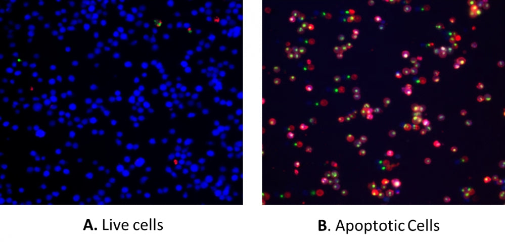Cell Meter™ Apoptotic and Necrotic Multiplexing Detection Kit II *Triple Fluorescence Colors* - AAT Bioquest