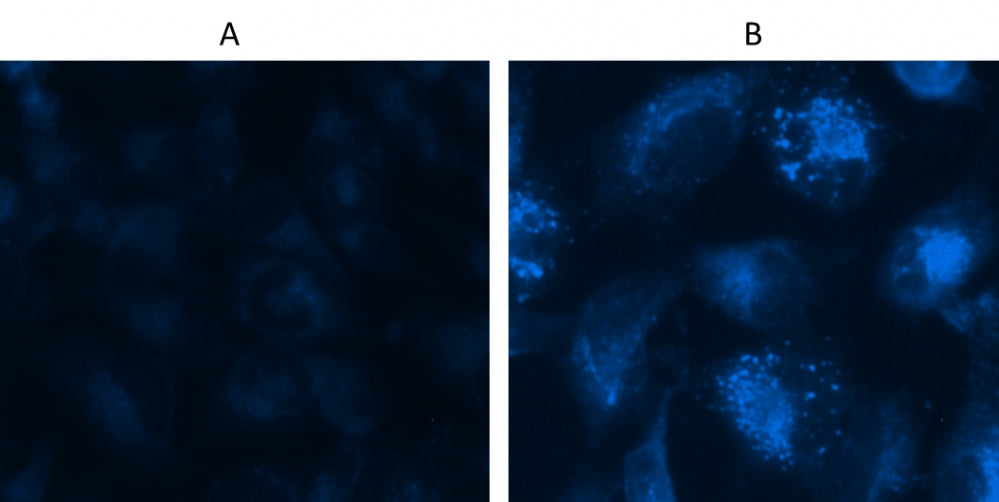 Cell Meter™ Autophagy Assay Kit *Blue Fluorescence* - AAT Bioquest