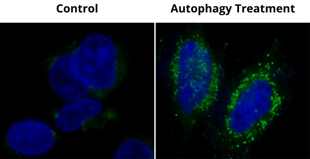 Cell Meter™ Autophagy Assay Kit *Green Fluorescence* - AAT Bioquest