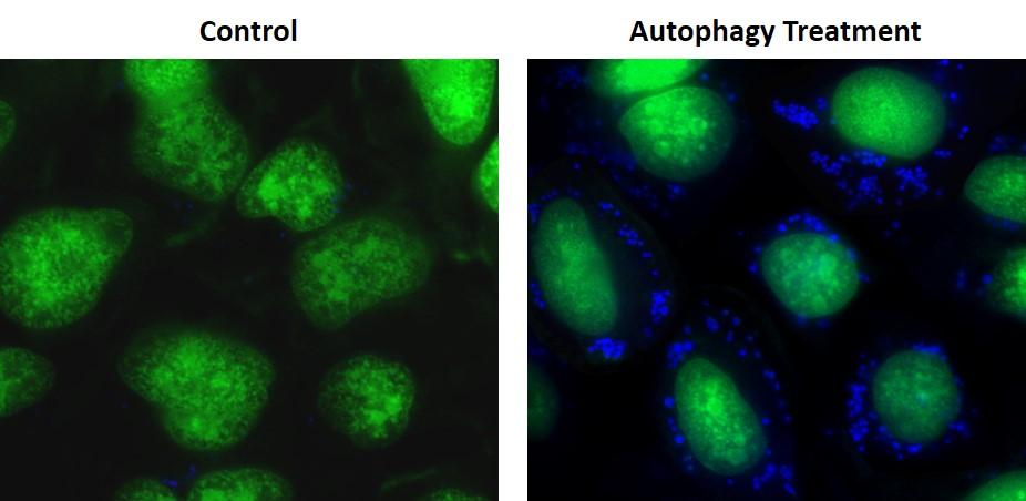 Cell Meter™ Autophagy Fluorescence Imaging Kit - AAT Bioquest
