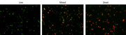 MycoLight™ Bacterial Viability Assay Kit - AAT Bioquest