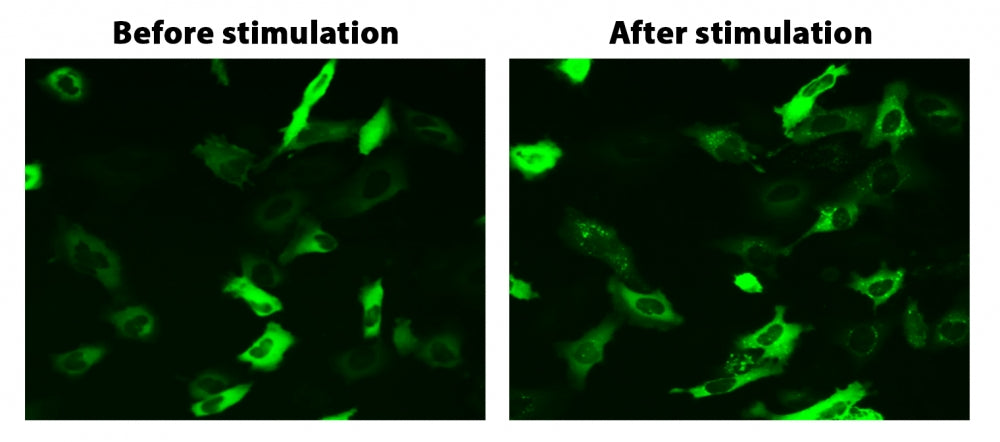 Cell Meter™ Beta-Arrestin Translocation GPCR Signaling Kit - AAT Bioquest