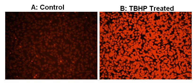 Cell Meter™ Fluorimetric Intracellular Total ROS Activity Assay Kit*Orange Fluorescence* - AAT Bioquest