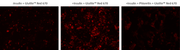 Cell Meter™ Glucose Uptake Imaging Kit *Red Fluorescence* - AAT Bioquest
