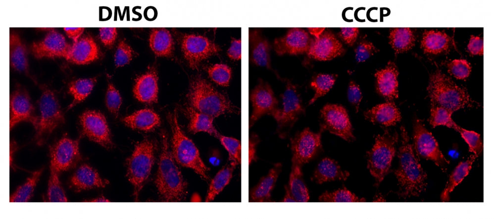 Cell Meter™ Mitochondrial Autophagy Imaging Kit *Red Fluorescence* - AAT Bioquest