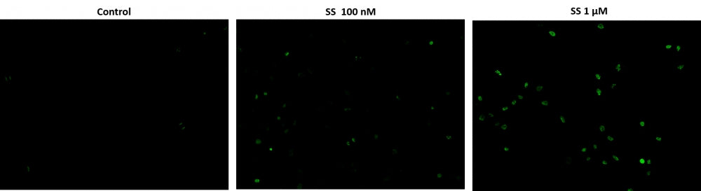 Cell Meter™ Live Cell TUNEL Apoptosis Assay Kit *Green Fluorescence* - AAT Bioquest