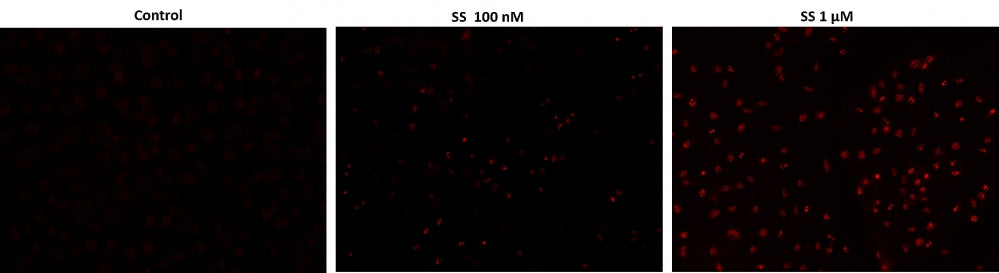 Cell Meter™ Live Cell TUNEL Apoptosis Assay Kit *Red Fluorescence* - AAT Bioquest