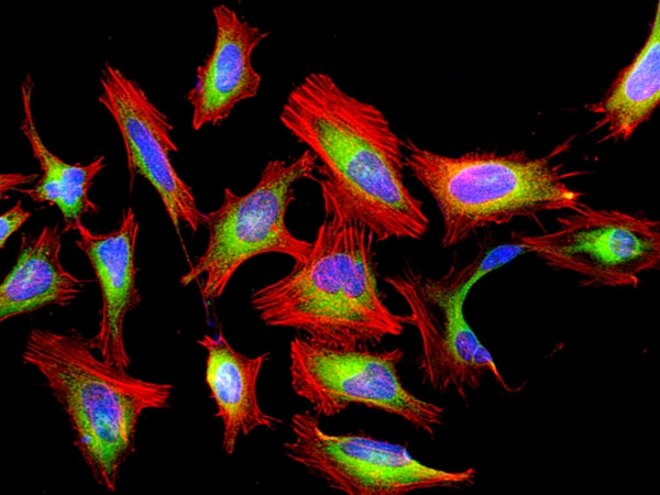 Cell Navigator® F-Actin Labeling Kit *Red Fluorescence* - AAT Bioquest