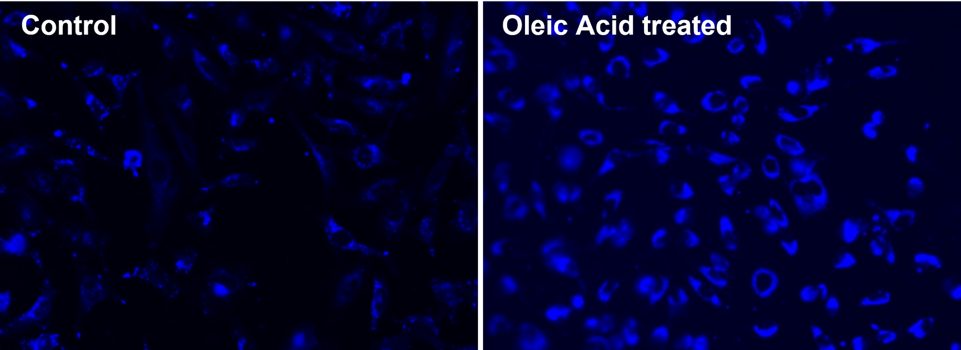 Cell Navigator® Fluorimetric Lipid Droplet Assay Kit *Blue Fluorescence* - AAT Bioquest
