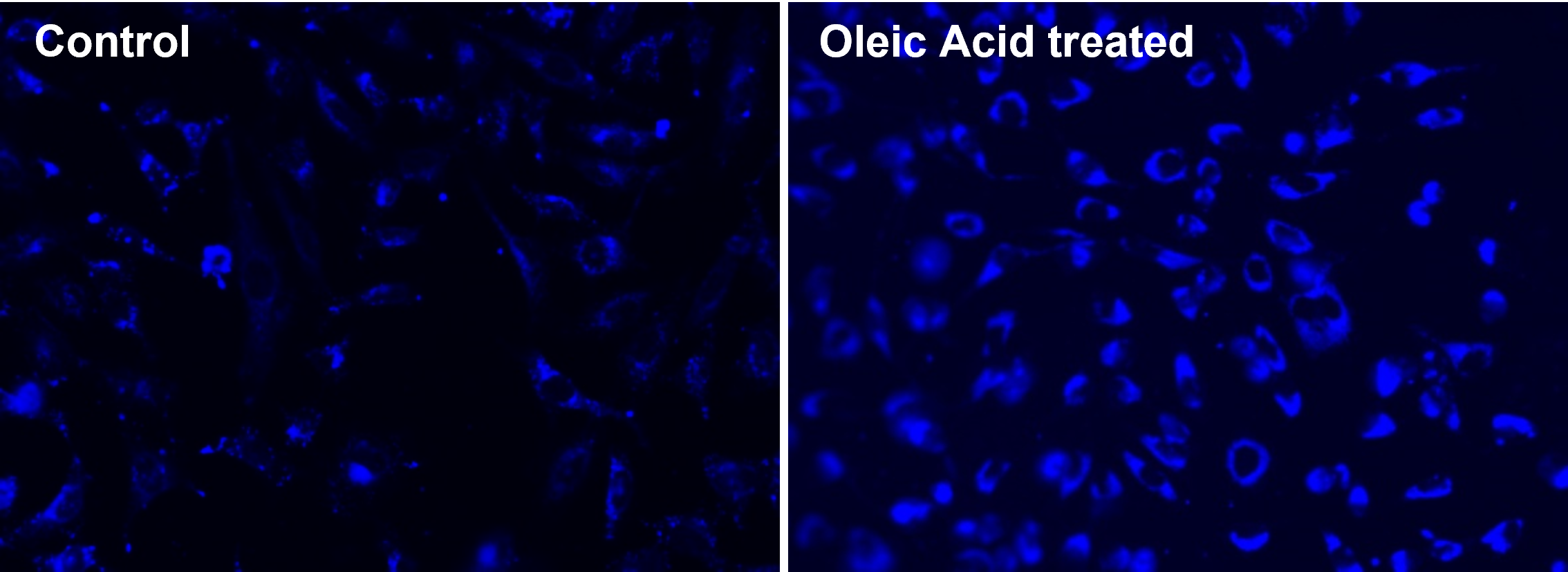 Cell Navigator® Fluorimetric Lipid Droplet Assay Kit *Blue Fluorescence* - AAT Bioquest